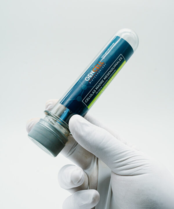 celulas troncales mesenquimales