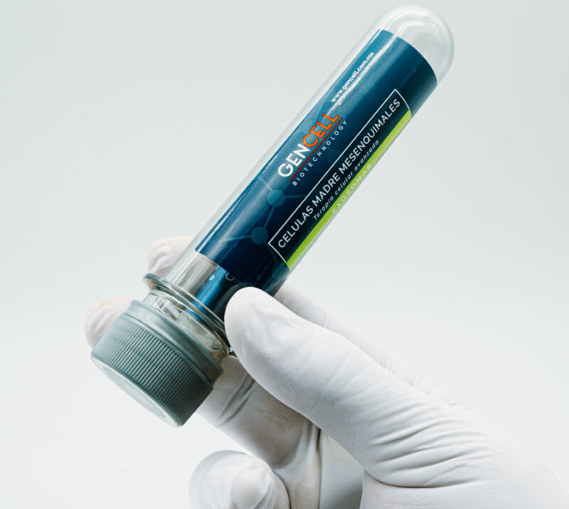 celulas troncales mesenquimales